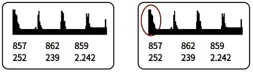 解決了共振后的回波信號